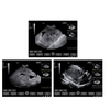 Portable Touch B/W Portable Veterinary Use Ultrasound Scanner System with Convex Probe