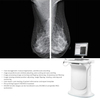 High-Resolution Digital Mammography System Electric Metal Mammography Machine with Low X-ray Dose