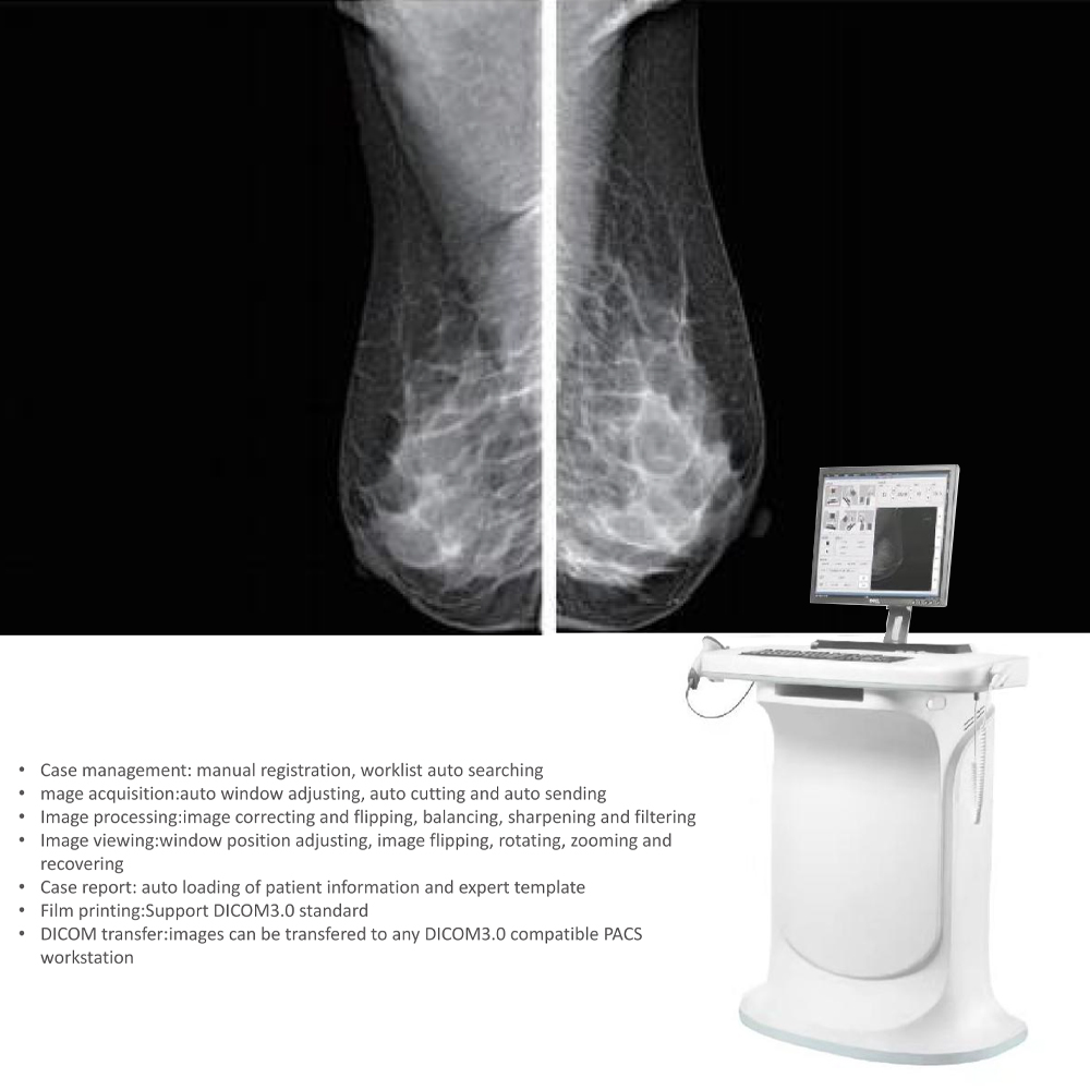 High-Resolution Digital Mammography System Electric Metal Mammography Machine with Low X-ray Dose