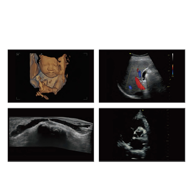 15.6 inch High-End CW Clinic 4D Color Doppler Ultrasound Scanner Premium Medical Ultrasound Instruments