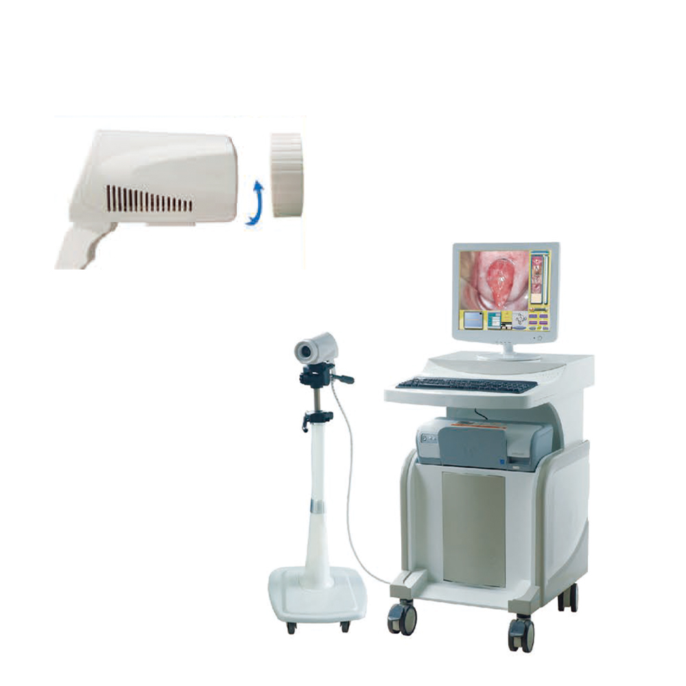 MAYAMED MY-F004B Wholesale Colposcope Price Digital Electronic Colposcope Colposcopy Machine Colposcope for Gynaecology