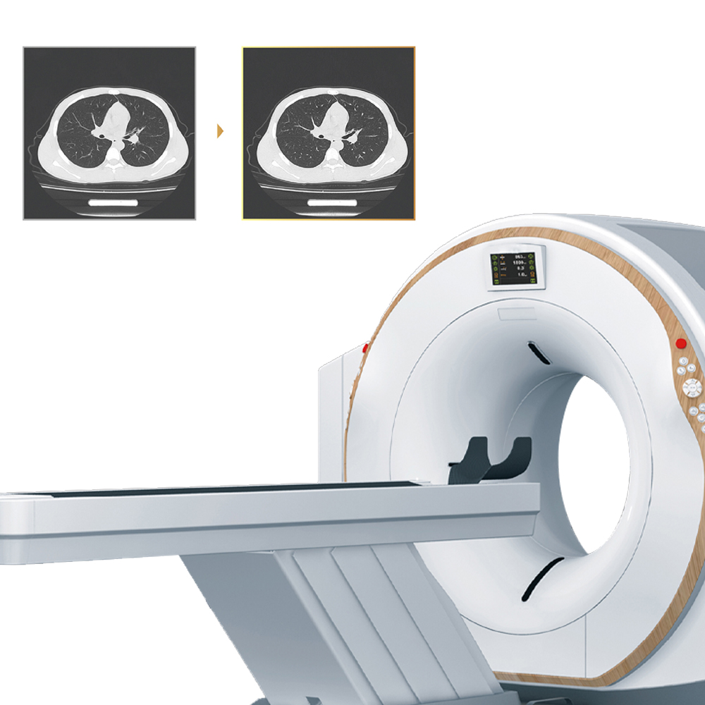 MY-D055P-N Medical Mri 4 16 32 64 128 Slice System Ct Scan Machine Scanner For Mobile Dr Computed Tomography