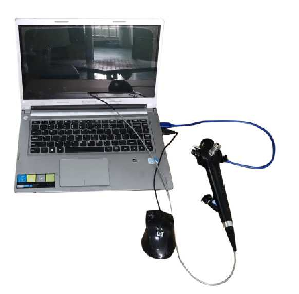 Medical Equipment Disposable Bronchoscope For Adult Use And Pediatra Use Portable Single Use Bronchoscope