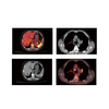 4 in 1 Veterinary PET-CT CT Scan Machine Computed Tomography CBCT Dynamic DR CT Scan Machine