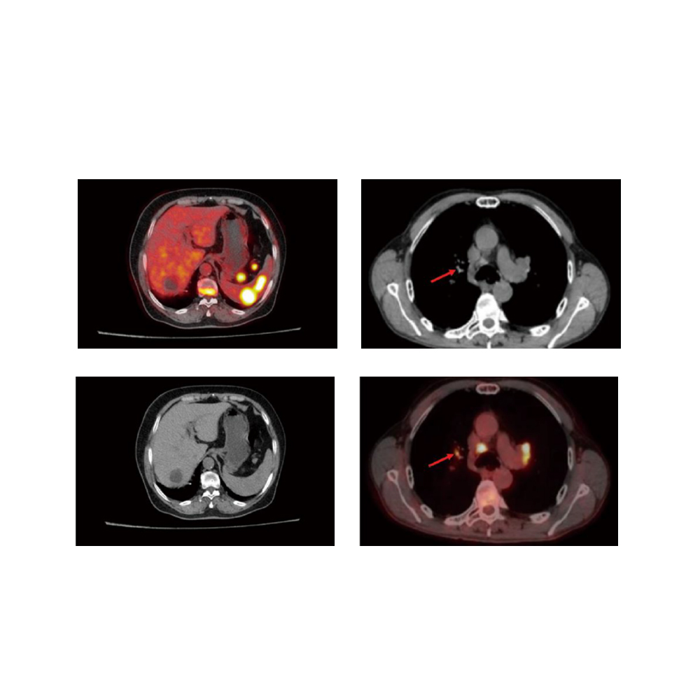 4 in 1 Veterinary PET-CT CT Scan Machine Computed Tomography CBCT Dynamic DR CT Scan Machine