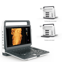 Medical ultrasound instruments cardiac digital color doppler 3d 4d ultrasound machine portable