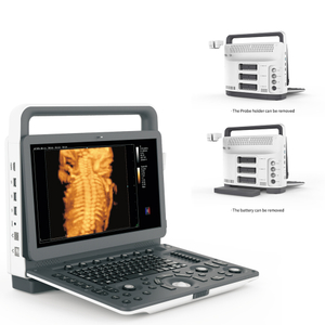 Medical ultrasound instruments cardiac digital color doppler 3d 4d ultrasound machine portable