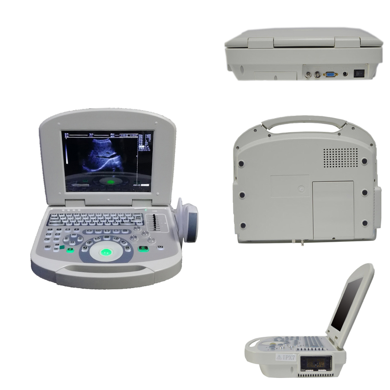 Full Digital Cheap Laptop Ultrasound Machine Device Scanner Laptop Ultrasound Device