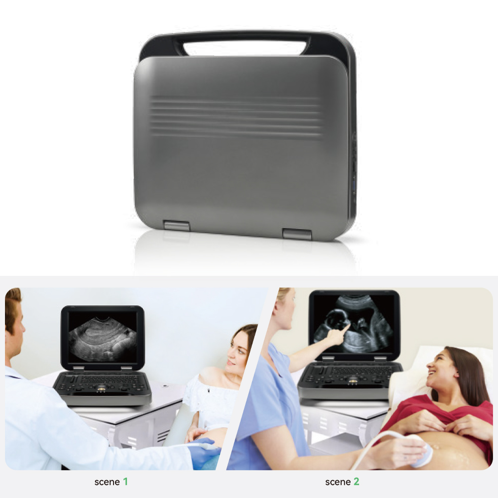 New Human Use Laptop Color Doppler Ultrasound Machine 2D 3D Echo Full Digital Ultrasound Scanner
