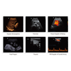 DP-50 Portable Ultrasonicay System Digital Ultrasonic Diagnostic Imaging System with Linear Probe
