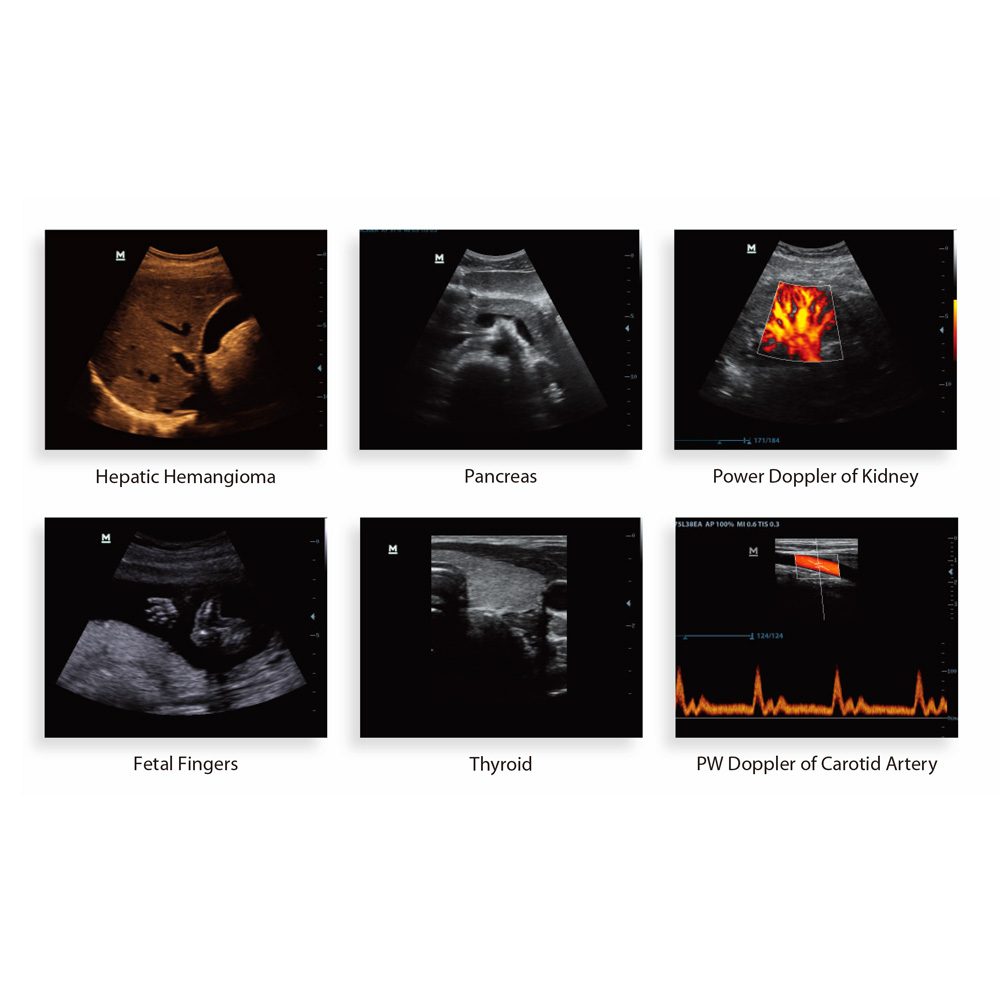 DP-50 Portable Ultrasonicay System Digital Ultrasonic Diagnostic Imaging System with Linear Probe