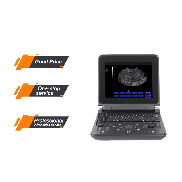  Ultrasound Probes Medical BW Laptop Ultrasound Machine With Scanner