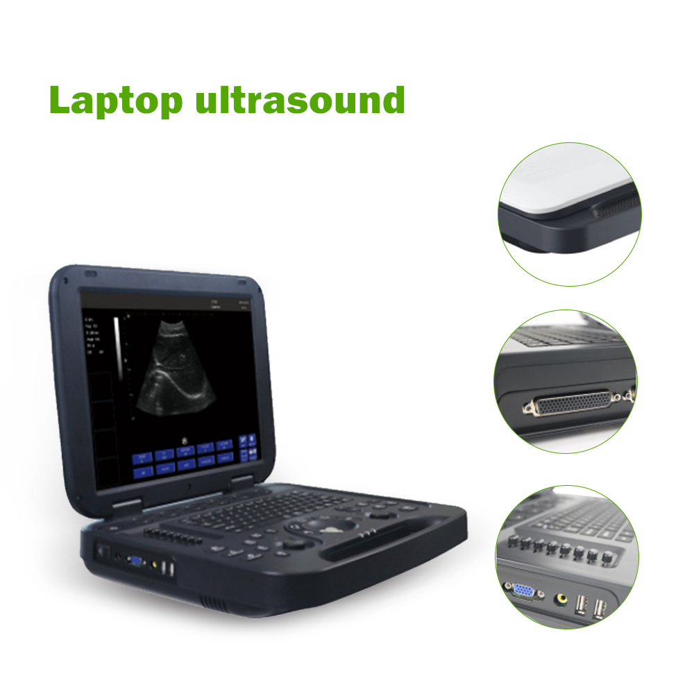 Cheap Veterinary Ultrasonic Machine Vet Portable Ultrasound Pregnancy Scanning Hand Held Ultrasound For Animal