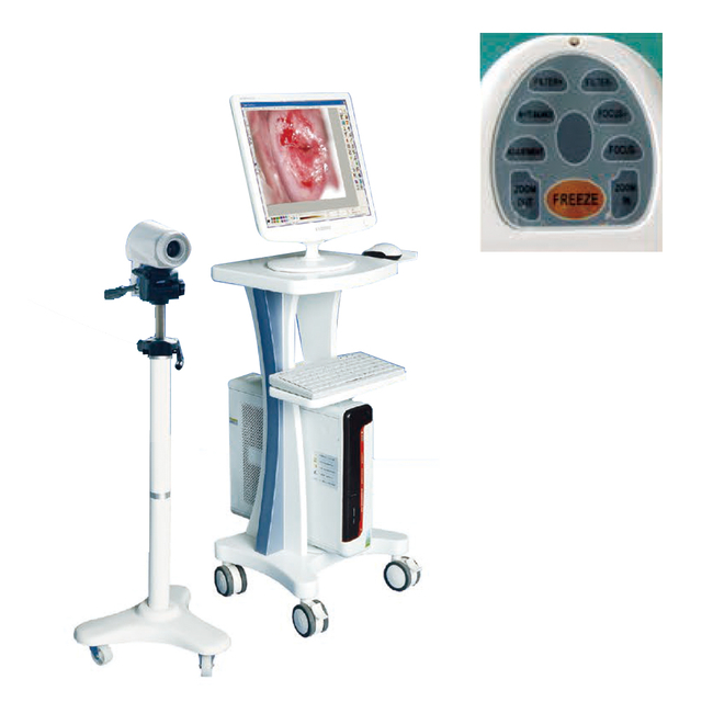 MAYAMED MY-F004B Wholesale Colposcope Price Digital Electronic Colposcope Colposcopy Machine Colposcope for Gynaecology