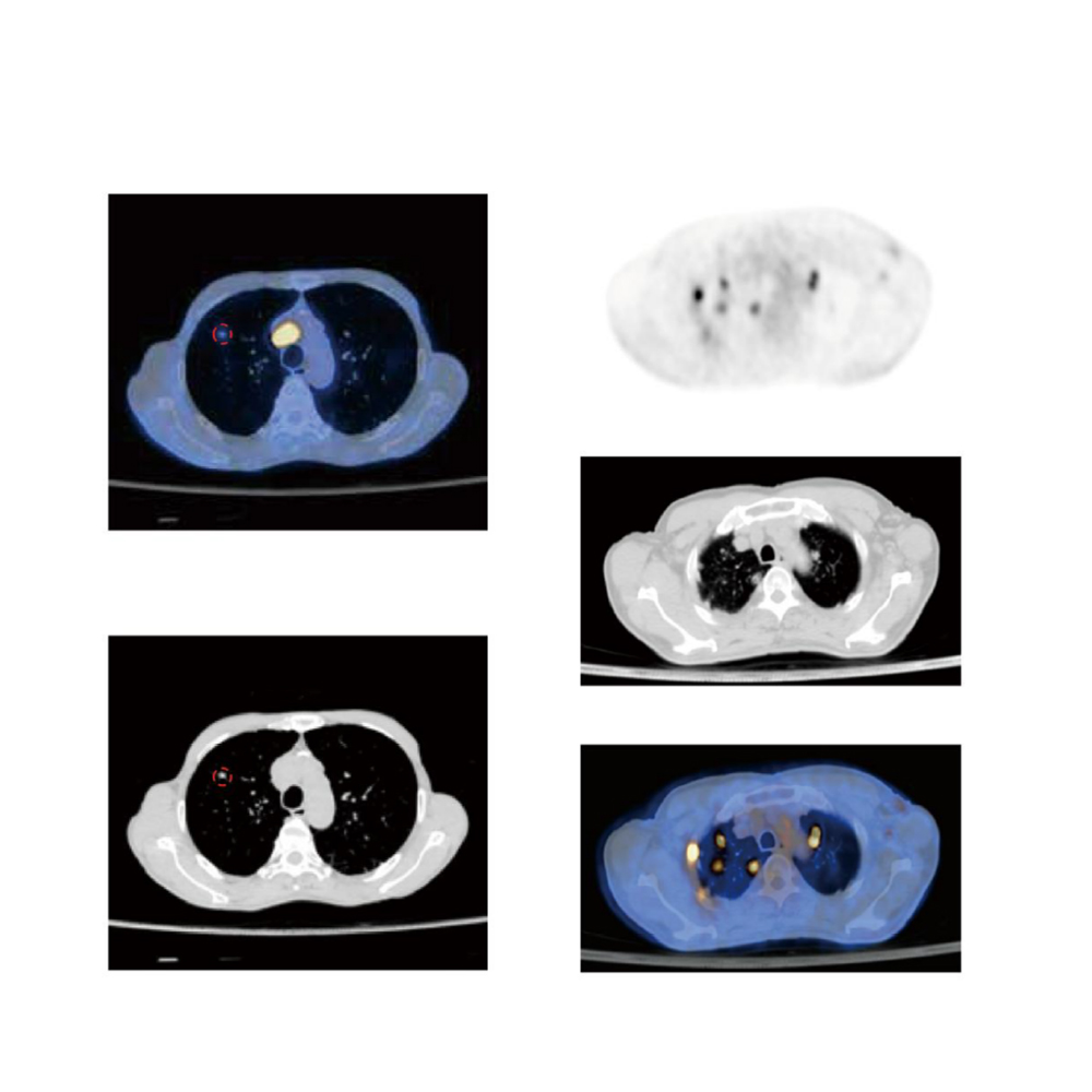 4 in 1 Veterinary PET-CT CT Scan Machine Computed Tomography CBCT Dynamic DR CT Scan Machine