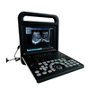 Multiple Languages Easy Operation Scanning Device Medical Portable Handheld Ultrasound Machine