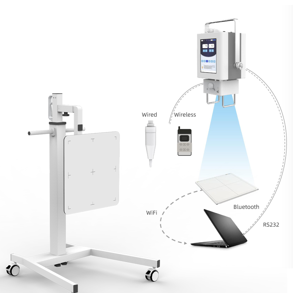 Hospital Radiography System 4Kw Dr High Frequency Portable Digital X Ray Machine for Human