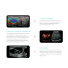 SONOSCAPE P12 Elite Electric Ultrasonic Transducer Convex Biopsy Guide Hospital Equipment