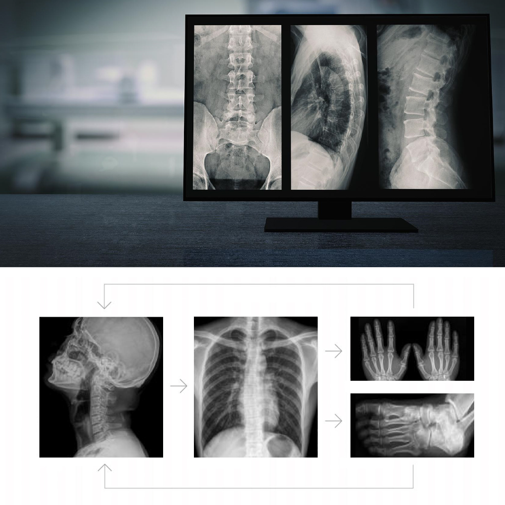 Portable And Mobile X Ray Machine Digital X-Ray Equipment for Human And Veterinary Imaging