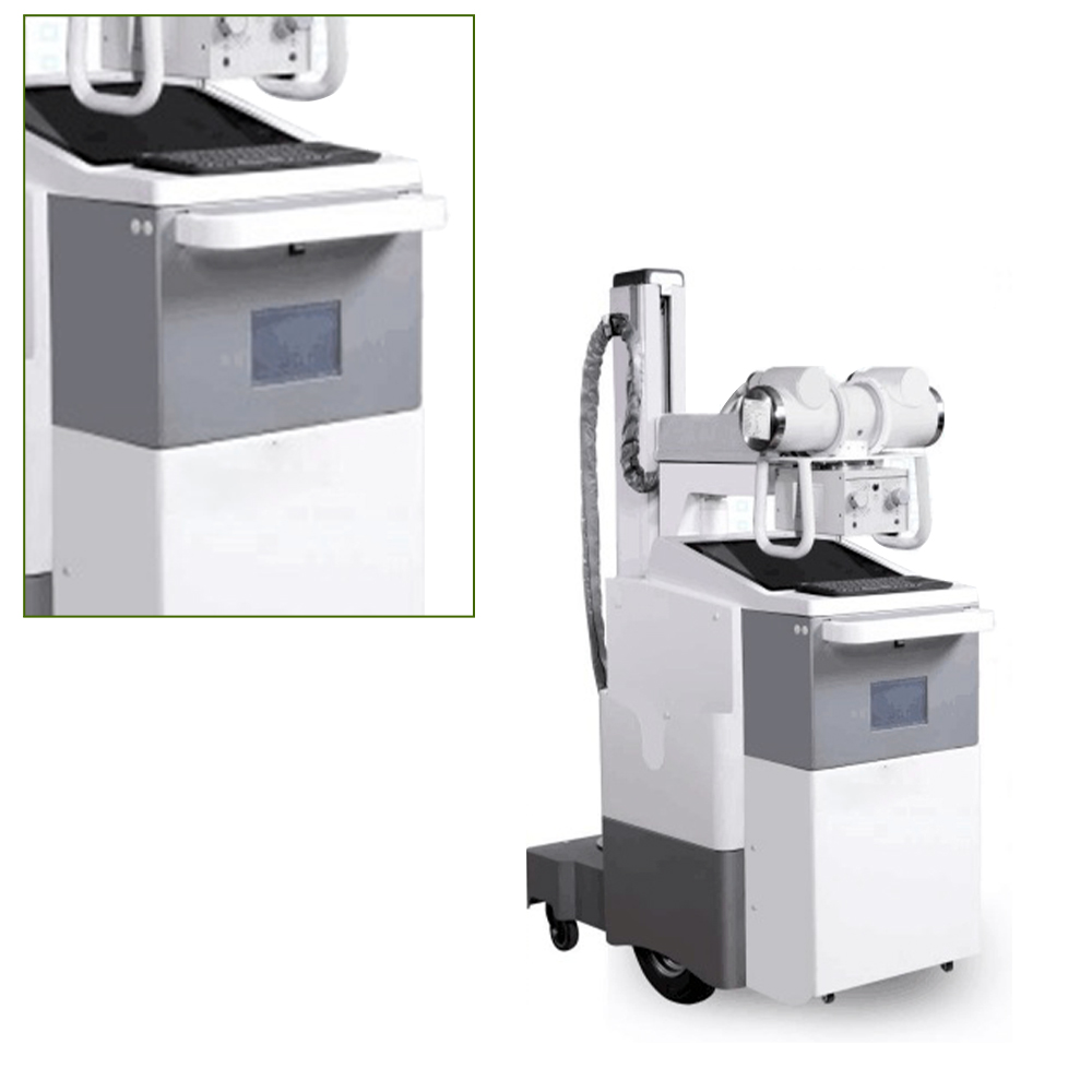 Digital X-ray Portable Radiography System Mobile X Ray Radiography Machine System