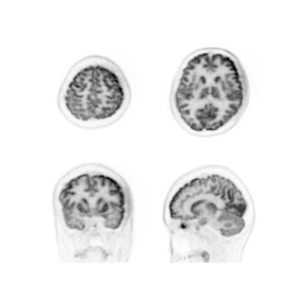 4 in 1 Veterinary PET-CT CT Scan Machine Computed Tomography CBCT Dynamic DR CT Scan Machine