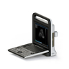 Multiple Languages Easy Operation Scanning Device Medical Portable Handheld Ultrasound Machine