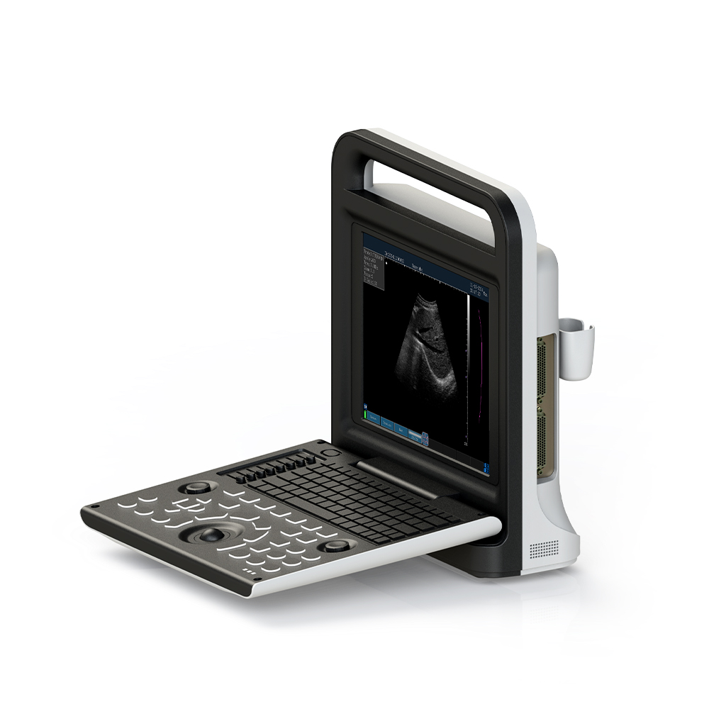 Multiple Languages Easy Operation Scanning Device Medical Portable Handheld Ultrasound Machine