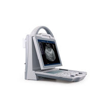 New Product Modern Classic Full Digital B Mode Ultrasonic Diagnostic Instruments for VET Use