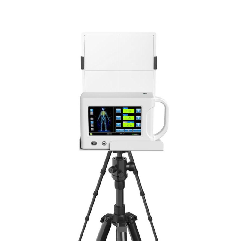 Super Mini Hand-held X-ray Machine Portable Medical Xray Radiology Machine For Medical