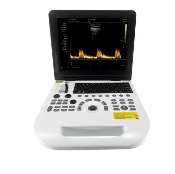 How Much Does An Ultrasound Machine Cost?