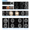 Mobile Medical Rapid Diagnosis CT Radiology CT Scanner Metal Computed Tomography Scanning Machine