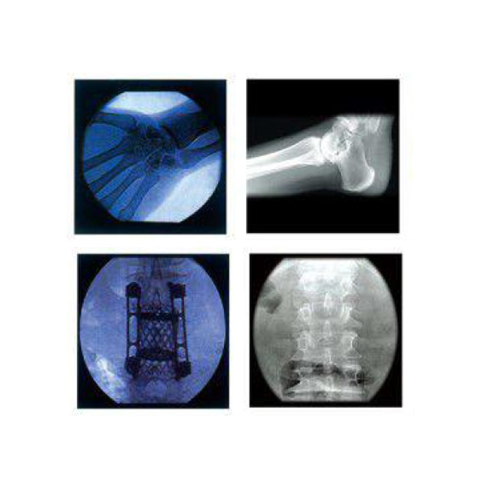 Electric DR X-Ray Radiology Machine Medical C-Arm X-Ray Surgical Equipment Durable Metal Construction