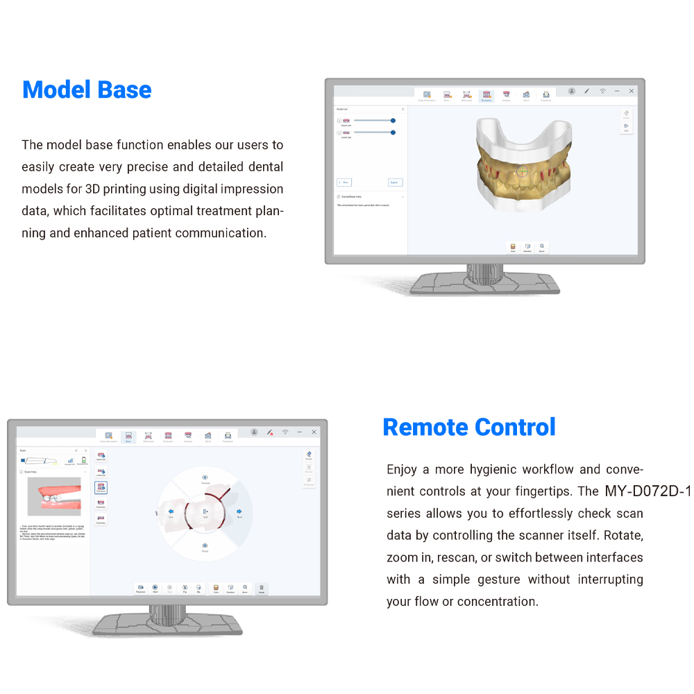 New Model Dental 3d Intraoral Scanner Oral Digital Impressions Device Dental Intraoral 3D Imaging System Scanner Intraoral