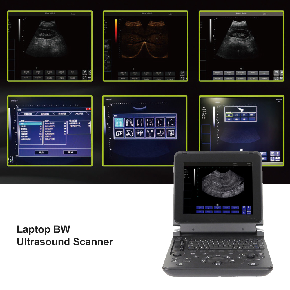  Ultrasound Probes Medical BW Laptop Ultrasound Machine With Scanner