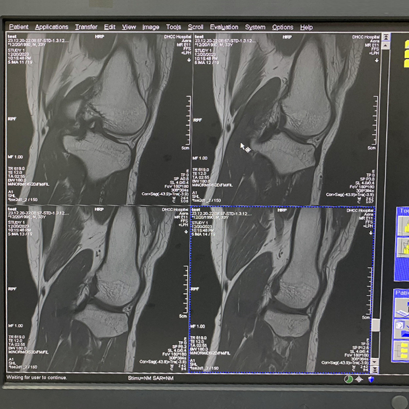 Used HiSpeed Single Slice CT Scanner for Sale