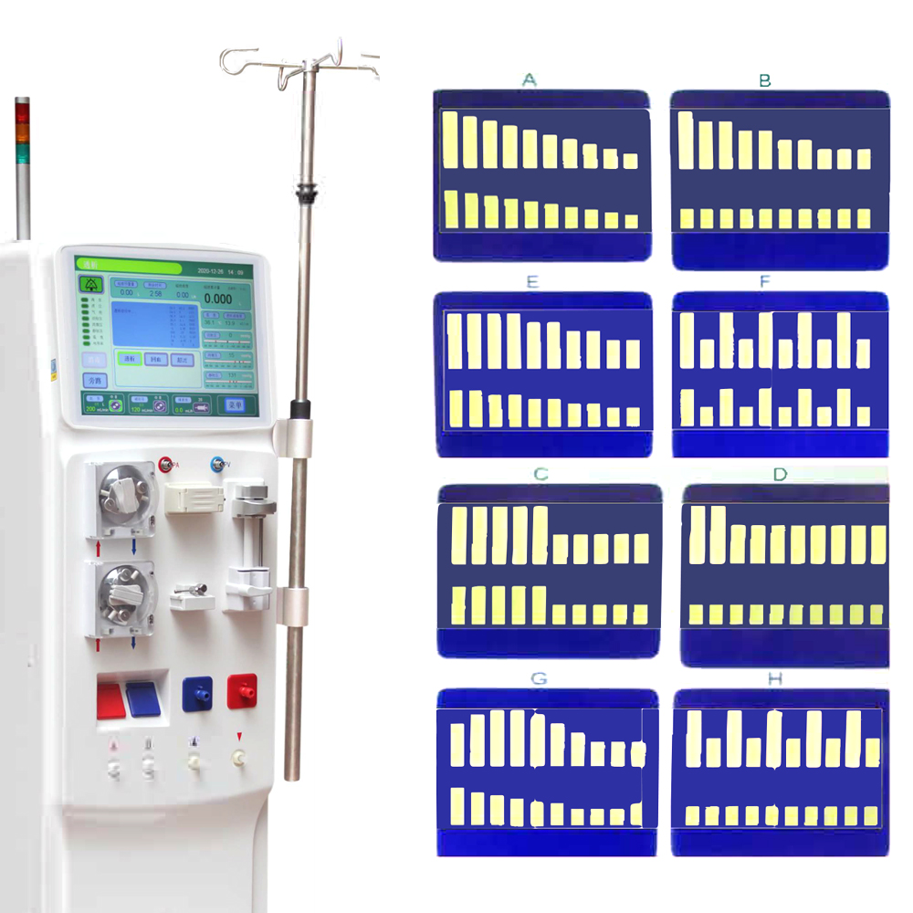 MAYAMED MY-O018 Hemodialysis Machine Price Dialysis Therapy Equipment Diagnostic Portable Medical Professional Manufacturer Supplier for Sale