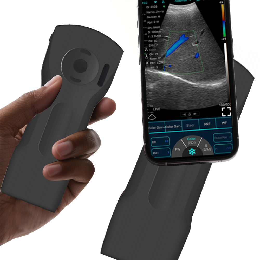 WIFI Wireless Probe 3 in 1 Convex Linear Cardiac Function Ultrasound for Ambulance