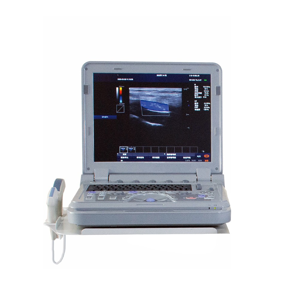 TCD Convex Probe Transcranial Doppler System Electric Medical Ultrasound Instrument Made of Metal