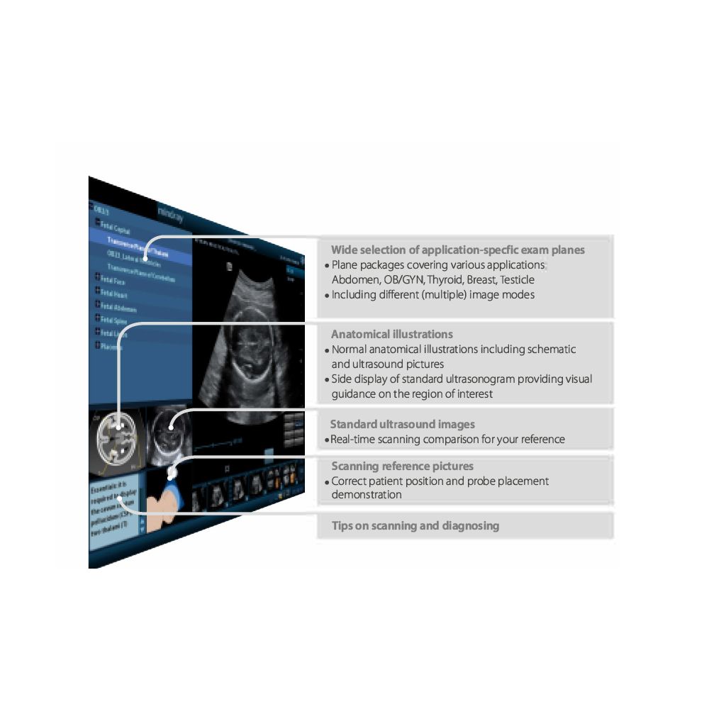 DC-26 Digital Ultrasound Therapy Machine with Convex Probe Electric Color Doppler Metal Construction
