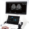 SONOSCAPE P12 Elite Electric Ultrasonic Transducer Convex Biopsy Guide Hospital Equipment