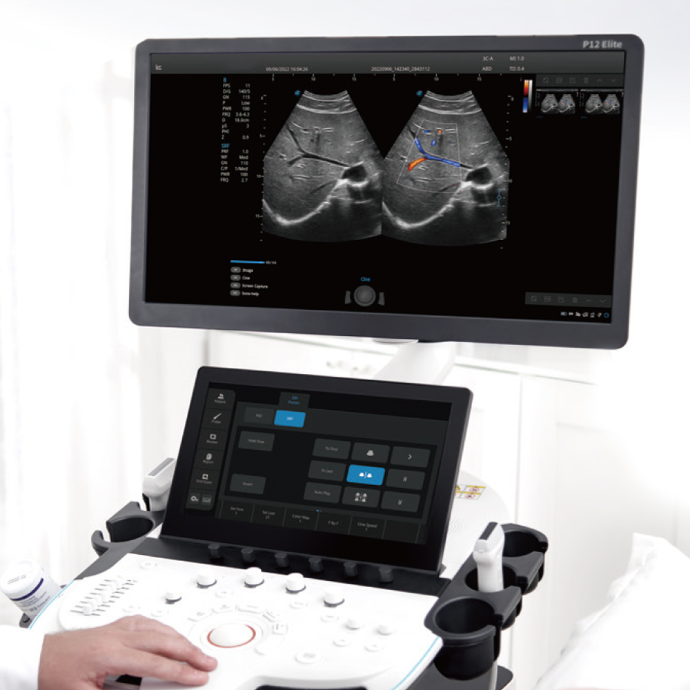 SONOSCAPE P12 Elite Electric Ultrasonic Transducer Convex Biopsy Guide Hospital Equipment