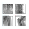 Precision Manufacturing C Arm X-Ray Unit C-Arm DR System Large Screen Electric C-Arm Metal Material