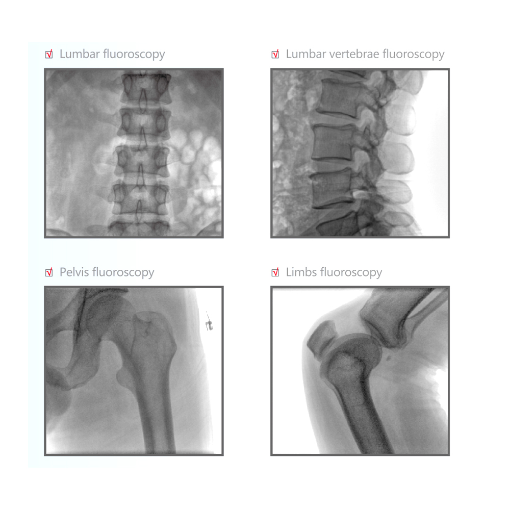 Precision Manufacturing C Arm X-Ray Unit C-Arm DR System Large Screen Electric C-Arm Metal Material