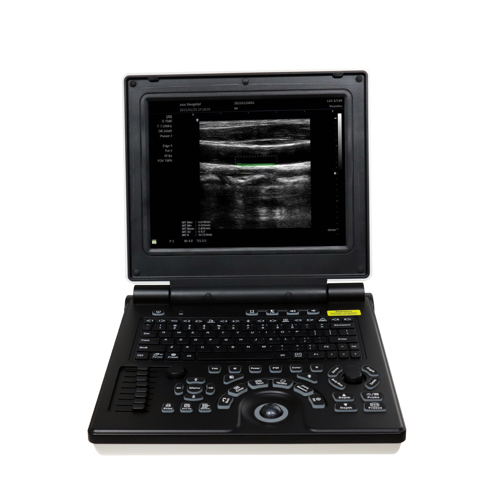 MAYA Medical Echographe Portable Ultrasound Scanner Vet Echo Color Doppler Ultrasound Machine 