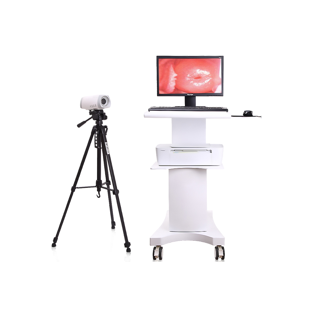 MAYAMED MY-F004 Full HD Digital Colposcope Vaginal Cervical Exam Colposcope Imaging System For Sale