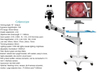 MY-F004A Trolley-type medical Digital Electronic Colposcope Video China Electronic Colposcope price for gynecology