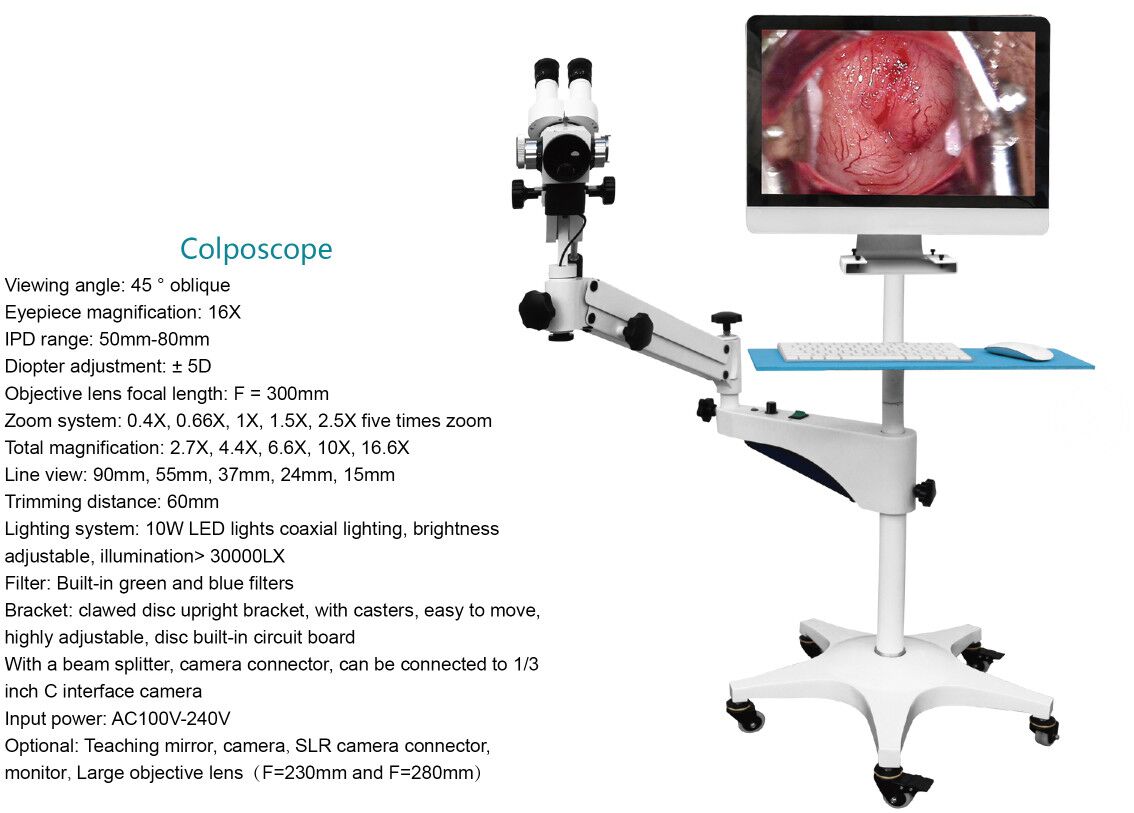 MY-F004A Trolley-type medical Digital Electronic Colposcope Video China Electronic Colposcope price for gynecology