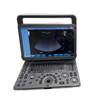 Medical ultrasound instruments cardiac digital color doppler 3d 4d ultrasound machine portable