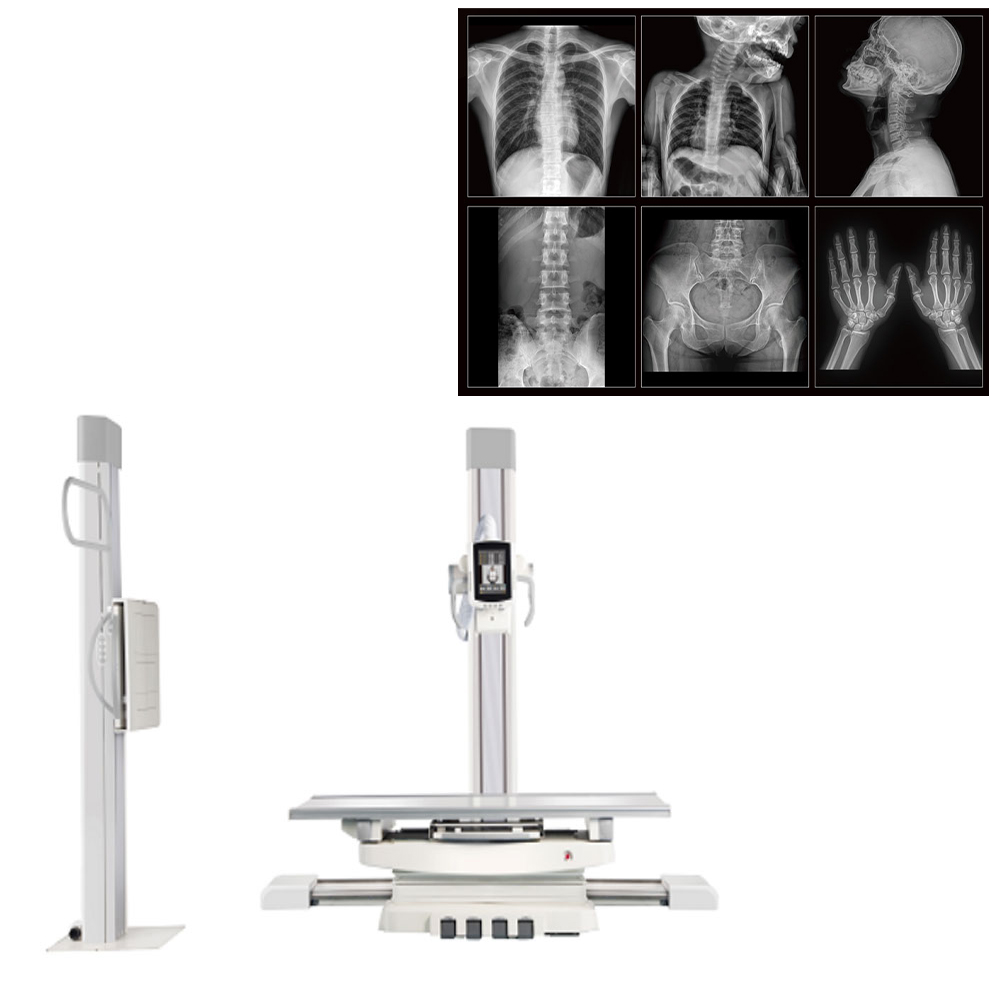 Electricity-Powered Metal X-Ray Machine for Medical Diagnostic Radiography Floor-Mounted Digital Radiography X Ray Machine
