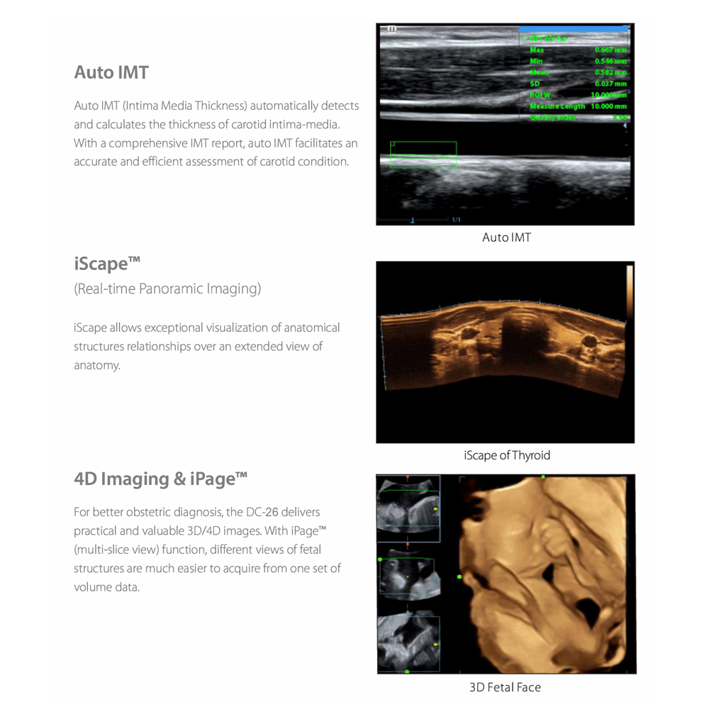 DC-26 Digital Ultrasound Therapy Machine with Convex Probe Electric Color Doppler Metal Construction